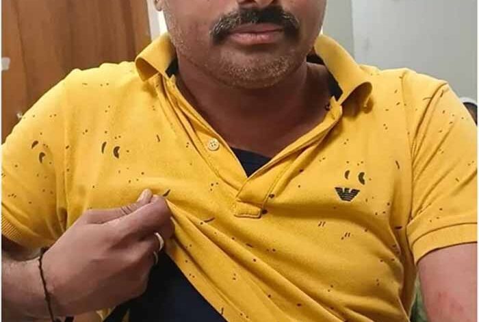 रतलाम में SIR सर्वे टीम पर पथराव: नायब तहसीलदार-ब्लो पर हमला, दो आरोपी दबोचे