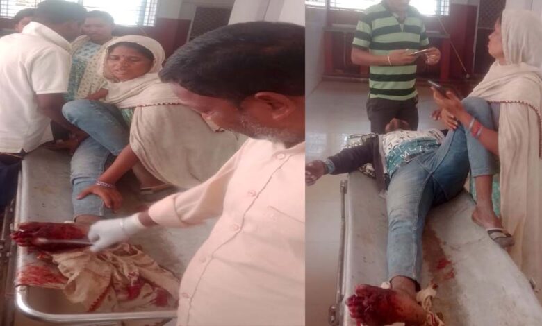 ऑटो और बाइक की भिंडत, बाइक चालक को आया गंभीर चोटें पैर की दो उंगली टूटने की आशंका