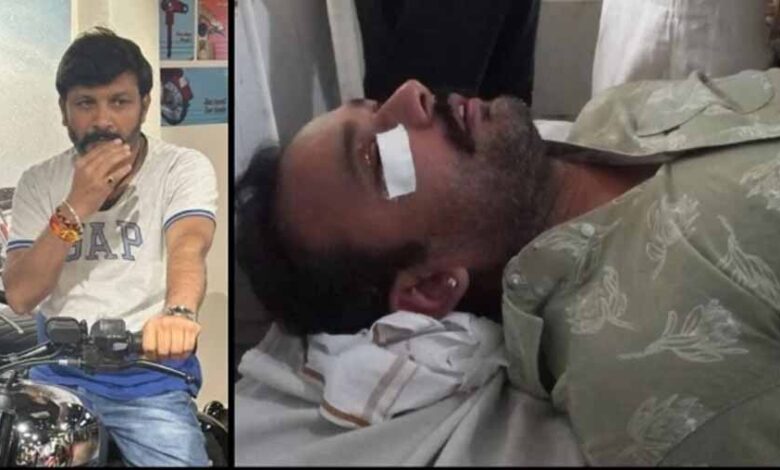 सतना में रोड टेंडर पर बवाल: हवाई फायरिंग के बाद पिस्टल की बट से हमला, CCTV खंगाल रही पुलिस